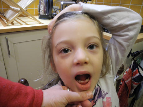 Première dent de perdu Première dent de perdu